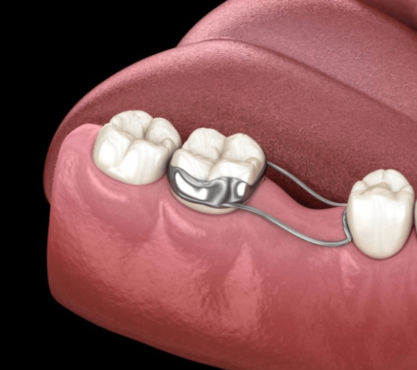 Местопазител